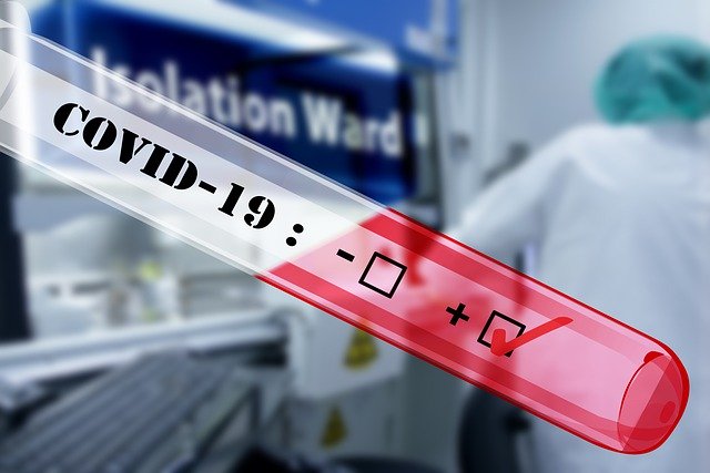 Gruppo CDP: nuove misure a sostegno delle imprese in conseguenza dell’emergenza Coronavirus
